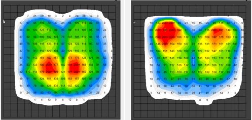 Pressure Mapping Assessment for Wheelchair Users